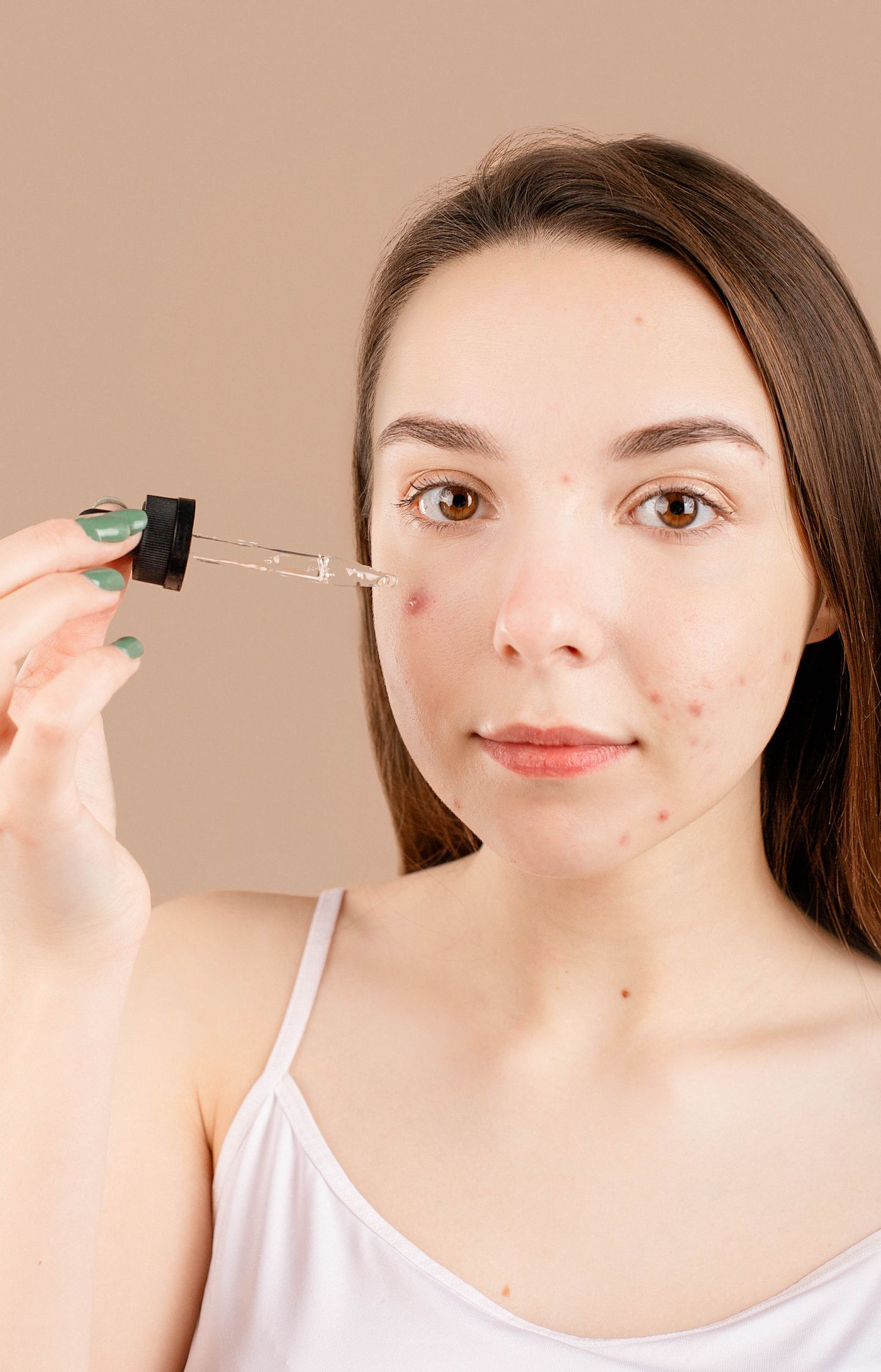 Tratamento de acne